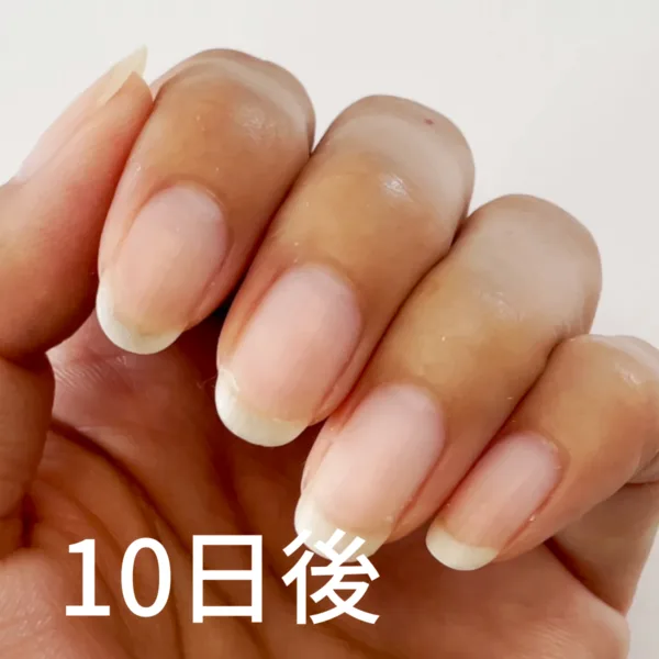 OYAネイキッド使用前とオフ後の爪の比較