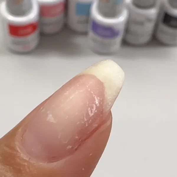 ダメージ具合