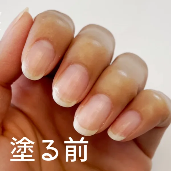 ZOYAネイキッドを塗る前と塗った後の爪の比較①