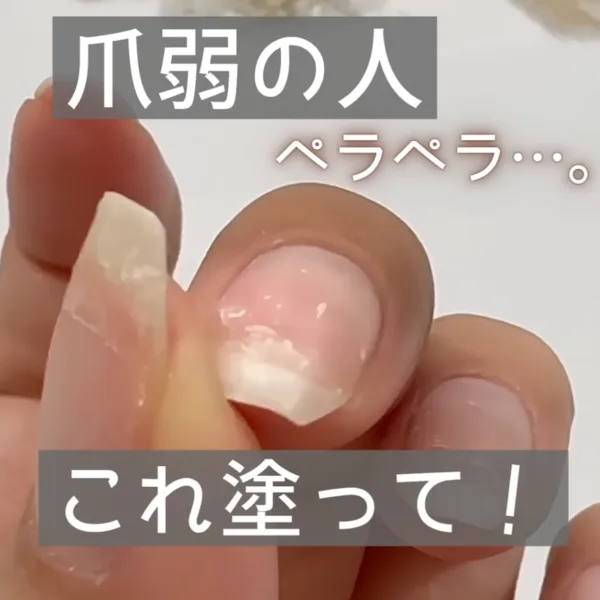 自爪の状態こんな感じ…。